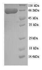 Recombinant Human Twinkle mtDNA helicase (TWNK) – Figure 1 of 1