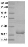 Recombinant Mouse Angiopoietin-like protein 8 (Angptl8) – Figure 1 of 1