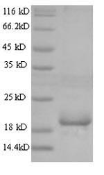 Recombinant Mouse Angiopoietin-like protein 8 (Angptl8) – Figure 1 of 1