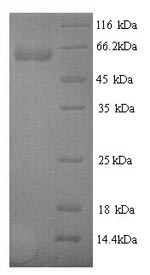 Recombinant Human N-acetylmuramoyl-L-alanine amidase (PGLYRP2) – Figure 1 of 1