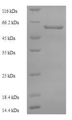 Recombinant Human Pseudokinase FAM20A (FAM20A) – Figure 1 of 1