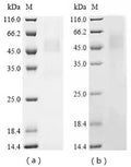 (Tris-Glycine gel) Discontinuous SDS-PAGE (reduced) with 5% enrichment gel and 15% separation gel.