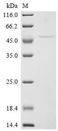(Tris-Glycine gel) Discontinuous SDS-PAGE (reduced) with 5% enrichment gel and 15% separation gel.