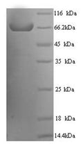 Recombinant Human Receptor-type tyrosine-protein phosphatase N2 (PTPRN2), partial – Figure 1 of 1