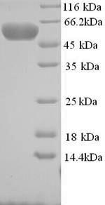 Recombinant Human E3 ubiquitin-protein ligase MYLIP (MYLIP) – Figure 1 of 1