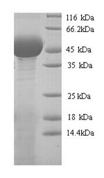 (Tris-Glycine gel) Discontinuous SDS-PAGE (reduced) with 5% enrichment gel and 15% separation gel.