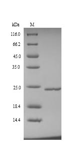 Recombinant Human Metalloproteinase inhibitor 4 (TIMP4) – Figure 1 of 1