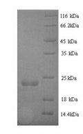 Recombinant Staphylococcus aureus Staphopain B (sspB) – Figure 1 of 1
