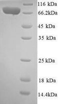 Recombinant Human Interleukin-12 receptor subunit beta-2 (IL12RB2), partial – Figure 1 of 1