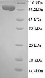 Recombinant Human Interleukin-12 receptor subunit beta-2 (IL12RB2), partial – Figure 1 of 1