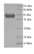 Recombinant Human Methionine synthase (MTR), partial – Figure 1 of 1