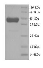 Recombinant Human Methionine synthase (MTR), partial – Figure 1 of 1