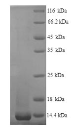 Recombinant Mouse Nogo-B receptor (Nus1), partial – Figure 1 of 1