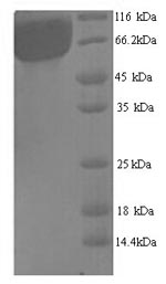 Recombinant Arabidopsis thaliana Trihelix transcription factor GT-1 (GT-1) – Figure 1 of 1