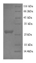 Recombinant Rabbit Interleukin-6 (IL6) – Figure 1 of 1