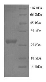 Recombinant Rabbit Interleukin-6 (IL6) – Figure 1 of 1