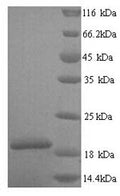 Recombinant Human Group XIIA secretory phospholipase A2 (PLA2G12A), partial – Figure 1 of 1