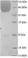 Recombinant Mouse BAG family molecular chaperone regulator 3 (Bag3) – Figure 1 of 1