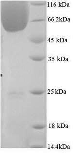 Recombinant Mouse BAG family molecular chaperone regulator 3 (Bag3) – Figure 1 of 1