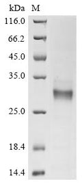 (Tris-Glycine gel) Discontinuous SDS-PAGE (reduced) with 5% enrichment gel and 15% separation gel.