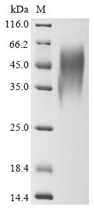 (Tris-Glycine gel) Discontinuous SDS-PAGE (reduced) with 5% enrichment gel and 15% separation gel.