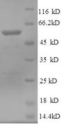 Recombinant Human Cytosolic 5'-nucleotidase 1A (NT5C1A) – Figure 1 of 1