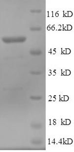 Recombinant Human Cytosolic 5'-nucleotidase 1A (NT5C1A) – Figure 1 of 1