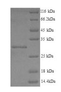 Recombinant Human Phospholysine phosphohistidine inorganic pyrophosphate phosphatase (LHPP) – Figure 1 of 1