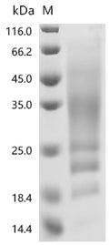 (Tris-Glycine gel) Discontinuous SDS-PAGE (reduced) with 5% enrichment gel and 15% separation gel.