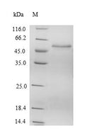 Recombinant Human Suppressor of SWI4 1 homolog (PPAN) – Figure 1 of 1