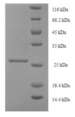 Recombinant Human Uncharacterized protein KIAA1377 (KIAA1377), partial – Figure 1 of 1