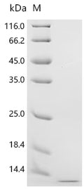 (Tris-Glycine gel) Discontinuous SDS-PAGE (reduced) with 5% enrichment gel and 15% separation gel.