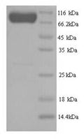 Recombinant Human E3 ubiquitin-protein ligase SMURF2 (SMURF2) – Figure 1 of 1