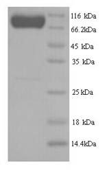 Recombinant Human E3 ubiquitin-protein ligase SMURF2 (SMURF2) – Figure 1 of 1