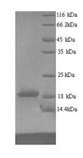 Recombinant Human Ribonucleoprotein PTB-binding 2 (RAVER2), partial – Figure 1 of 1
