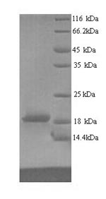 Recombinant Human Ribonucleoprotein PTB-binding 2 (RAVER2), partial – Figure 1 of 1