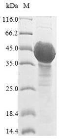 (Tris-Glycine gel) Discontinuous SDS-PAGE (reduced) with 5% enrichment gel and 15% separation gel.