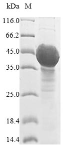 (Tris-Glycine gel) Discontinuous SDS-PAGE (reduced) with 5% enrichment gel and 15% separation gel.