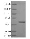Recombinant Arabidopsis thaliana Probable WRKY transcription factor 2 (WRKY2), partial – Figure 1 of 1