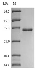 (Tris-Glycine gel) Discontinuous SDS-PAGE (reduced) with 5% enrichment gel and 15% separation gel.