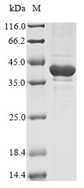 (Tris-Glycine gel) Discontinuous SDS-PAGE (reduced) with 5% enrichment gel and 15% separation gel.