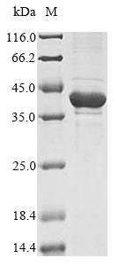 (Tris-Glycine gel) Discontinuous SDS-PAGE (reduced) with 5% enrichment gel and 15% separation gel.