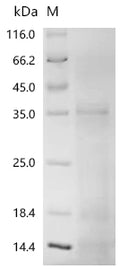 (Tris-Glycine gel) Discontinuous SDS-PAGE (reduced) with 5% enrichment gel and 15% separation gel.