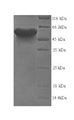 Recombinant Mouse Leucine-rich repeat and immunoglobulin-like domain-containing nogo receptor-interacting protein 1 (Lingo1),