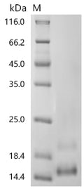(Tris-Glycine gel) Discontinuous SDS-PAGE (reduced) with 5% enrichment gel and 15% separation gel.