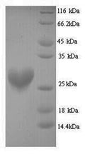 Recombinant Mouse Ribosyldihydronicotinamide dehydrogenase [quinone] (Nqo2) – Figure 1 of 1