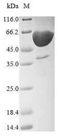 Recombinant Human Delta-like protein 3 (DLL3), partial – Figure 1 of 1
