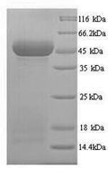 Recombinant Human Protein Wnt-10a (WNT10A) – Figure 1 of 1