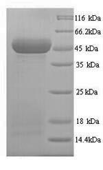 Recombinant Human Protein Wnt-10a (WNT10A) – Figure 1 of 1
