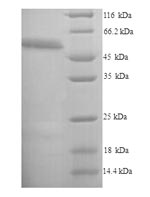 Recombinant Mouse Receptor-interacting serine/threonine-protein kinase 3 (Ripk3) – Figure 1 of 1